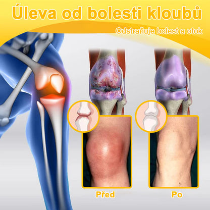 (speciálně pro starší dospělé, doporučeno Českou společností pro ortopedii a traumatologii – ČSOT)𝑨𝒓𝒕𝒉𝒓𝒐𝑭𝒓𝒆𝒆™🌿 𝑲𝒓é𝒎 𝒔 𝒗č𝒆𝒍í𝒎 𝒋𝒆𝒅𝒆𝒎 𝒏𝒂 ú𝒍𝒆𝒗𝒖 𝒐𝒅 𝒃𝒐𝒍𝒆𝒔𝒕𝒊 𝒂 𝒉𝒐𝒋𝒆𝒏í 𝒌𝒐𝒔𝒕í