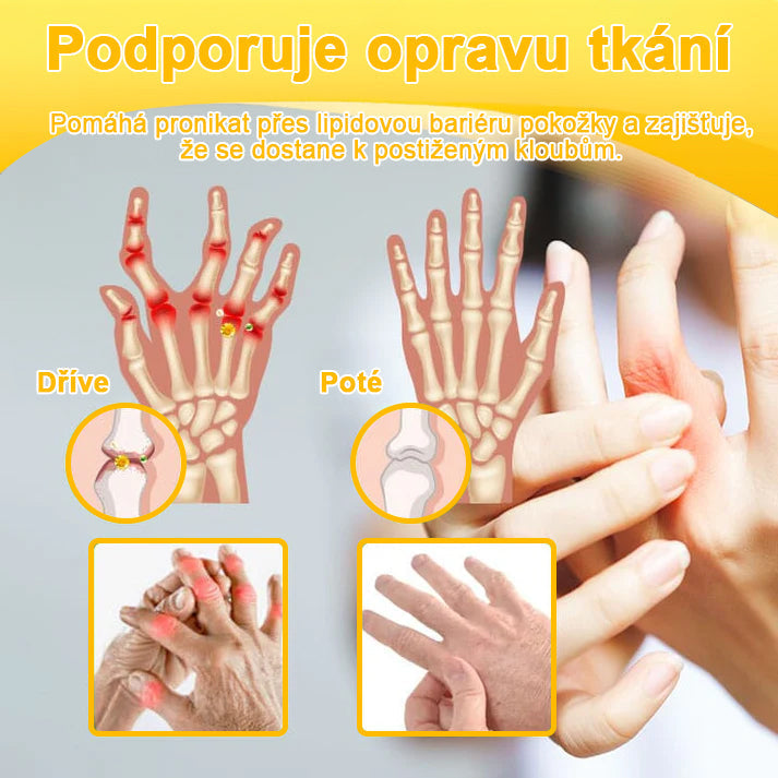 (speciálně pro starší dospělé, doporučeno Českou společností pro ortopedii a traumatologii – ČSOT)𝑨𝒓𝒕𝒉𝒓𝒐𝑭𝒓𝒆𝒆™🌿 𝑲𝒓é𝒎 𝒔 𝒗č𝒆𝒍í𝒎 𝒋𝒆𝒅𝒆𝒎 𝒏𝒂 ú𝒍𝒆𝒗𝒖 𝒐𝒅 𝒃𝒐𝒍𝒆𝒔𝒕𝒊 𝒂 𝒉𝒐𝒋𝒆𝒏í 𝒌𝒐𝒔𝒕í